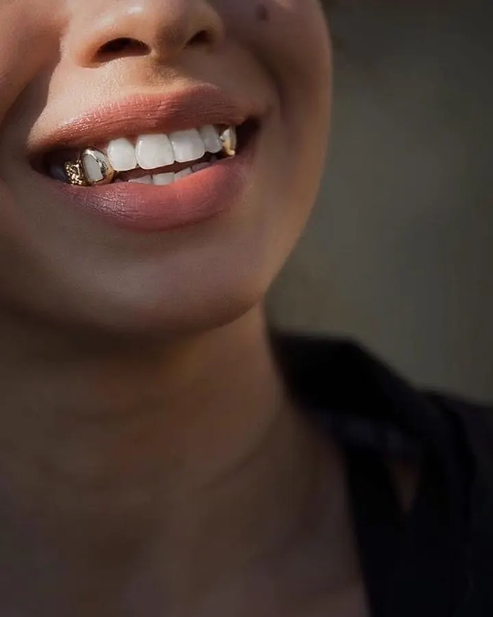 Plan rapproché du sourire d'une femme, montrant une dent ornée d'un bijou doré